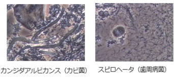 位相差顕微鏡で確認できる菌の一部